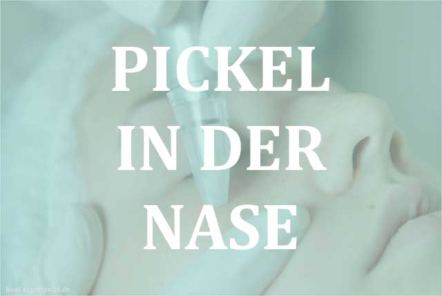 Pustel und Pickel in der Nase durch Bakterien?